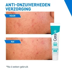 Online Geconcentreerde Anti-Onzuiverheden Verzorging Dermacare|Gezichtsreiniging