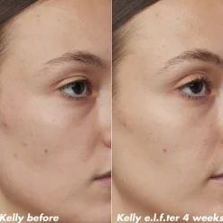 Outlet e.l.f. Skin PLZ Clarify Facial Oil Serum