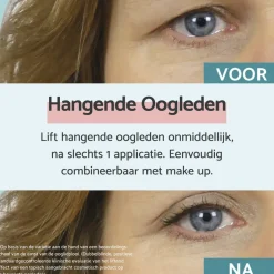 Hot Hangende Oogleden Oogcrème Oogcreme