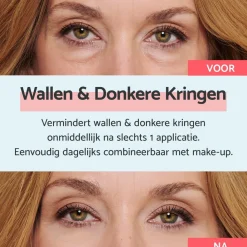 Wallen & Donkere Kringen Crème Oogcreme