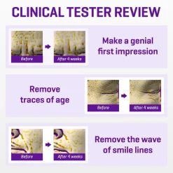 Hot SOME BY MI Retinol Intense Advanced Triple Action Eye Cream Korean Skincare|Oogcreme